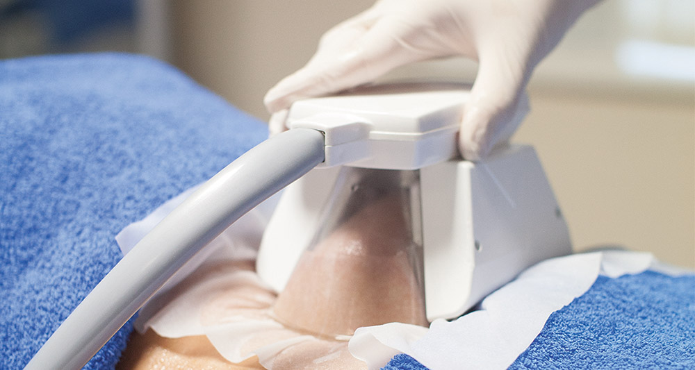 How Fat Freezing and HIFU Work Together? 2 Multiple Areas in One Session HIFU and Fat Freezing Hemel Hempstead