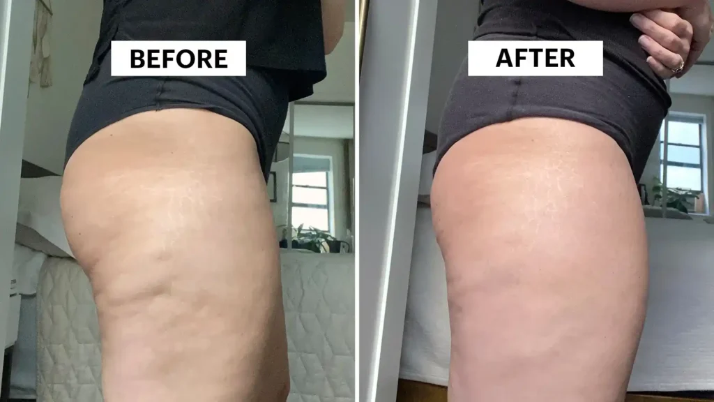 Do Toning Exercise Hemel Hempstead Really Tackle Cellulite?