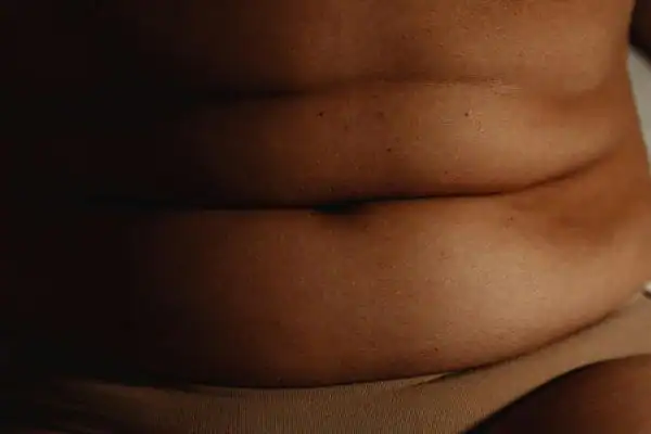 The Hidden Connection: How Stress Shapes Your Fitness and Body Composition 3 image of what stress can do on the stomach area and how Lipo 360 Hemel Hempstead can help to change your body shape.